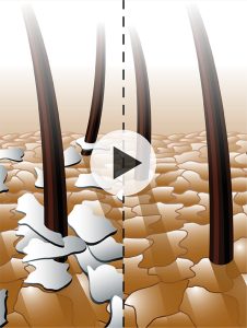 K05 Dandruff Intense Treatment